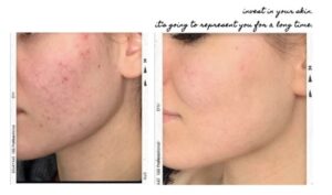Skin Care
